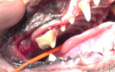 口峡部の炎症・潰瘍